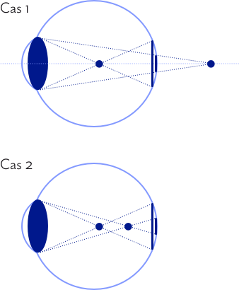 The house of eyewear - article l'astigmatisme