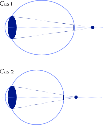 The house of eyewear - article hypermétropie